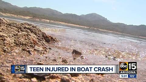 Teen struck by boat in the middle of 7-hour surgery