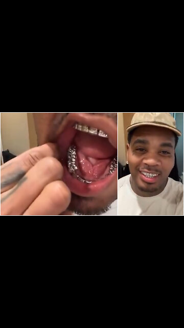 Kevin Gates shows off his new grill while his smoke detector batteries are on their last legs