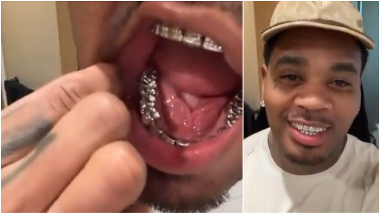 Kevin Gates shows off his new grill while his smoke detector batteries are on their last legs