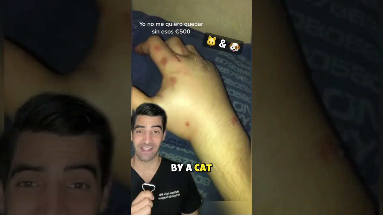 Cat and Dog Bites