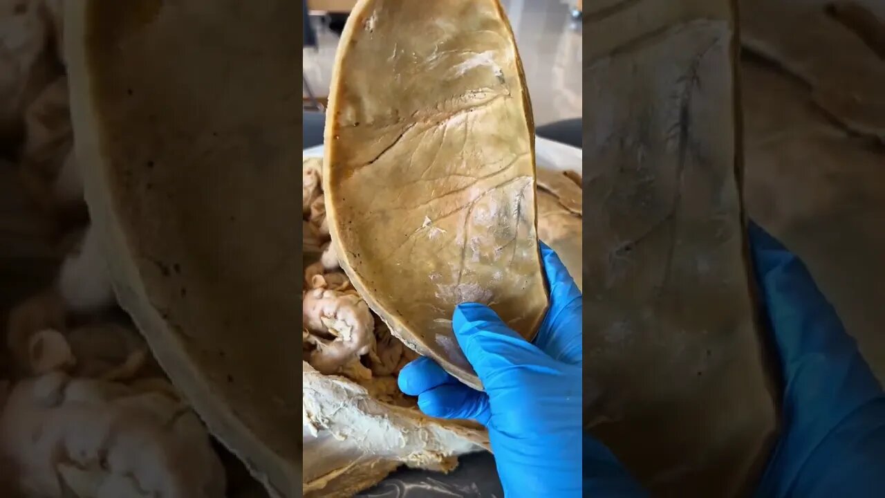 What’s On the INSIDE of a Human Skull?