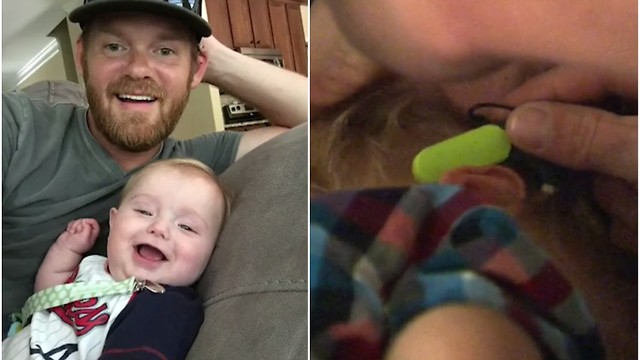 Mom Is Upset When Her Son Inherits a Trait from His Dad, So Undergoes He Surgery to Change It.