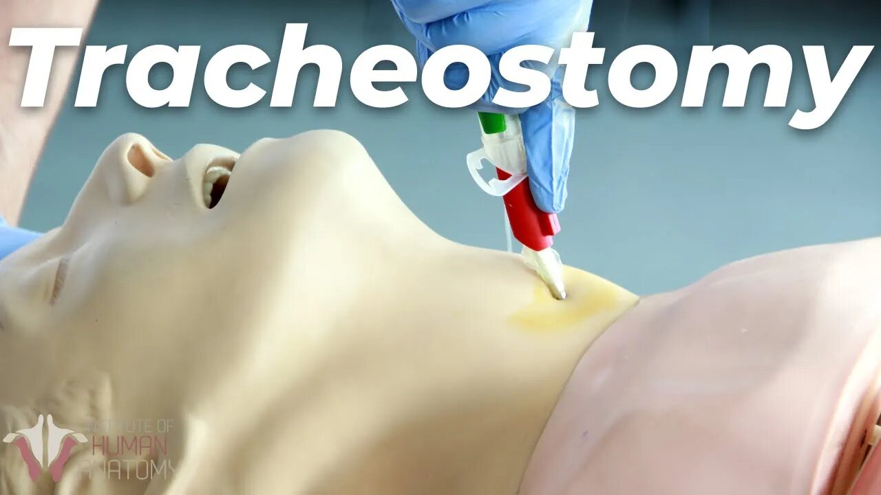 How to Perform a Tracheostomy