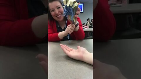 Prosthetics? Video By sparkly ot #Shorts