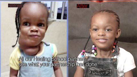 Healing Streams Testimony | Child with Large Growth on Neck Receives Healing!