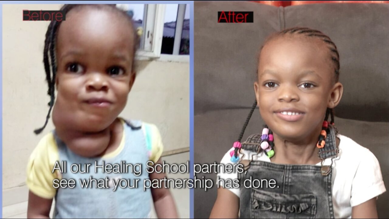 Healing Streams Testimony | Child with Large Growth on Neck Receives Healing!