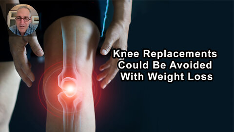 There's A Whole Lot Of Knee Replacements We Could Avoid If We Got People To Lose Weight
