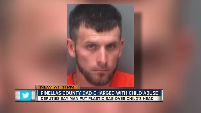 Father arrested, accused of putting plastic bag over head of crying 1-year-old