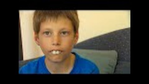 Strangers Help Boy Get New Teeth - This Is Him Now