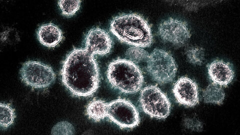 Vax Shedders Causing Rectal Bleeding?!
