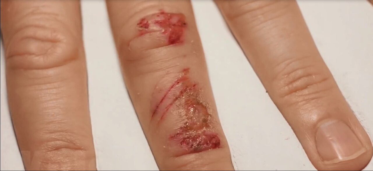 Timelapse Of A Wound Healing