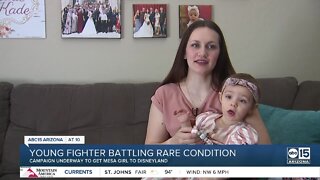 One-year-old Mesa girl battling rare condition that causes seizures