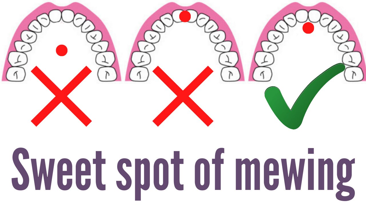 Sweet Spot Correct Tongue Posture