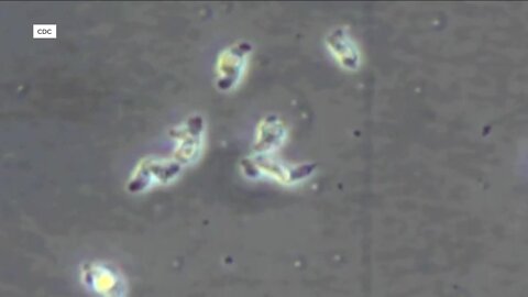 CDC: Potentially deadly amoeba not detected in samples from Florida patient