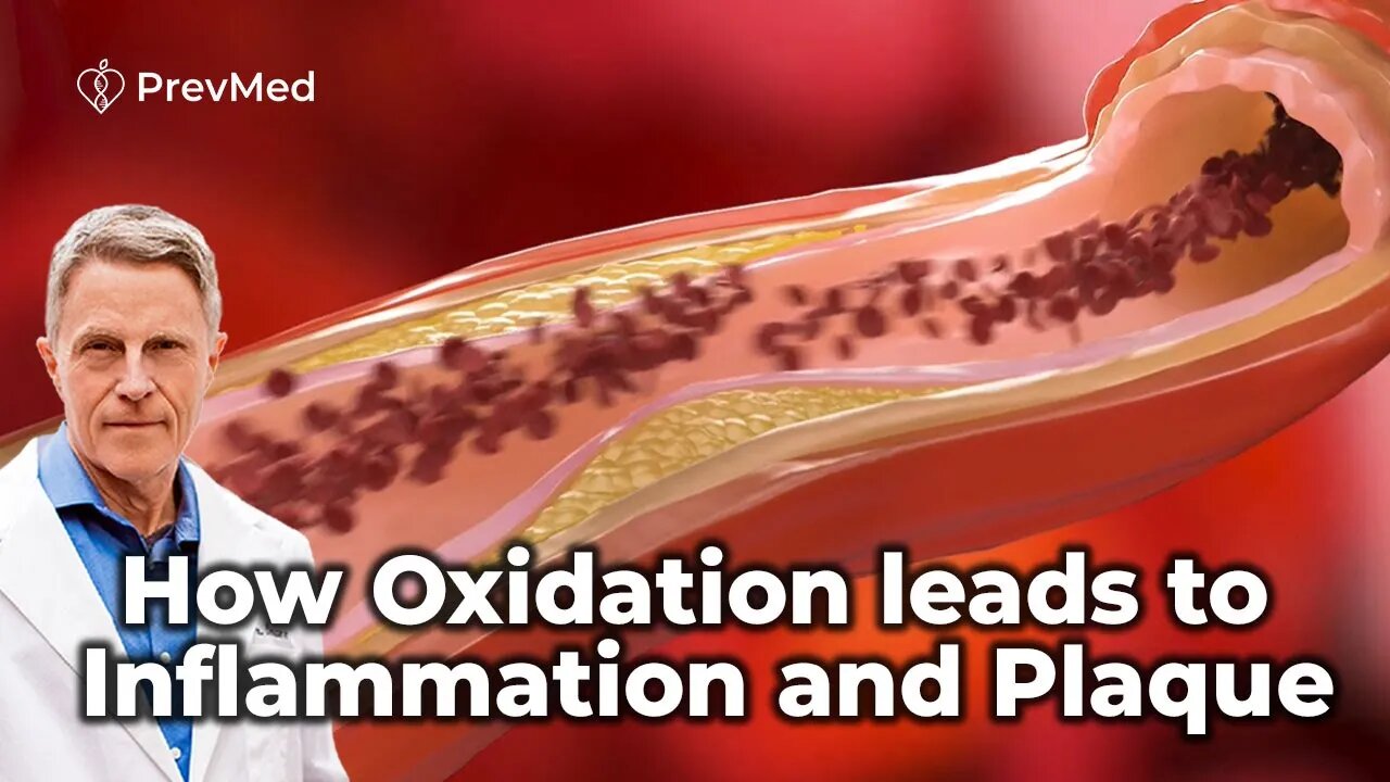 How Oxidation leads to Inflammation and Plaque