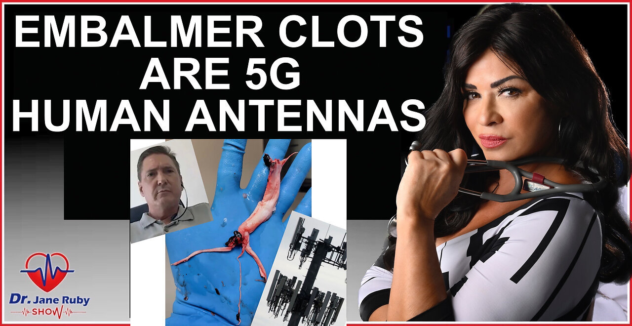 BOMBSHELL: PROOF EMBALMER CLOTS ARE 5G CONTROLLED HUMAN ANTENNAS