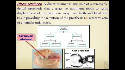 Prosthodontics L8 part1 (Mandibular Major Connectors)