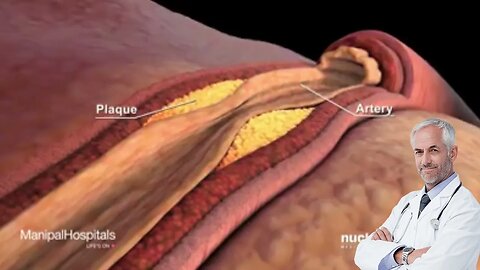 Understanding your Cholesterol _ Best Health Tips _ Health Education