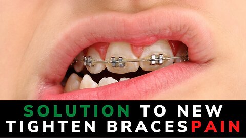how to get rid of braces pain｜｜new braces pain｜｜tighten braces pain
