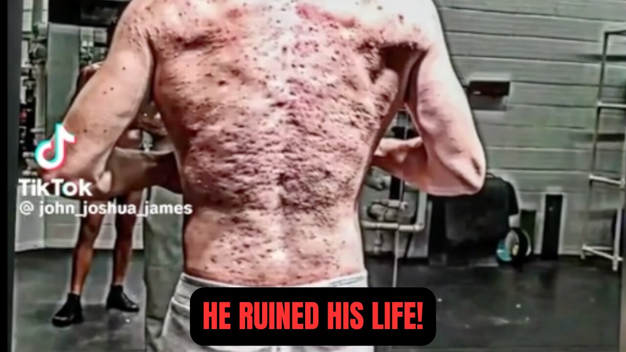 Steroids Can Ruin Your Life - DON'T FALL FOR THE TRAP