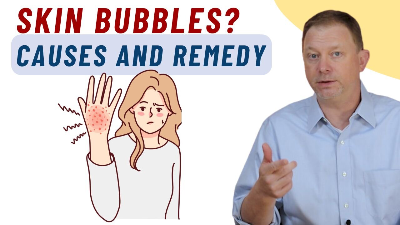 Those Weird Skin Bubbles: Causes and Remedy