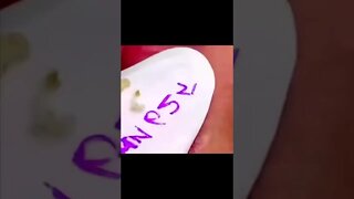 Satisfying Lips Blackheads Removal