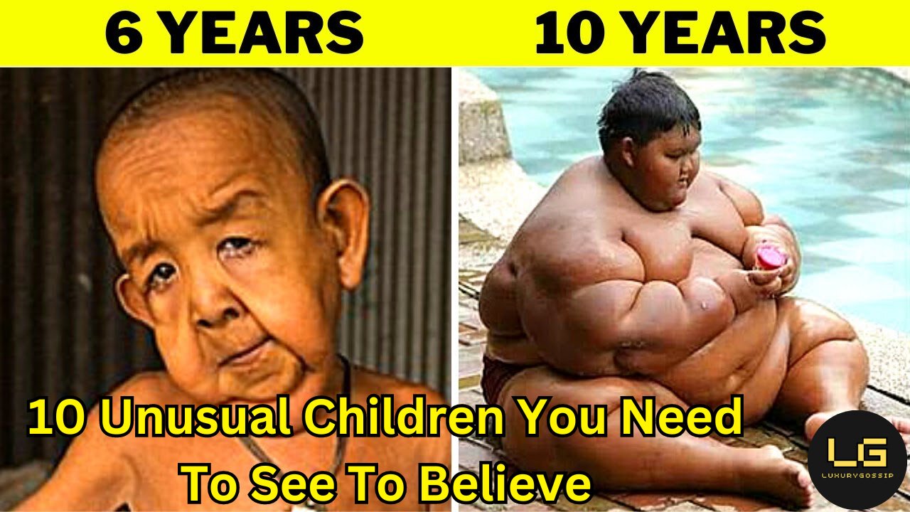 10 Unusual Children You Need To See To Believe