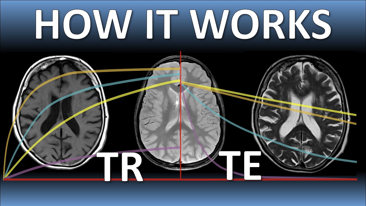 TR, TE & MRI Image Weighting EXPLAINED (Lecture 7)