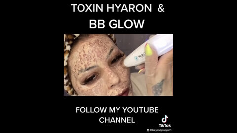 Hyaron BB GLOW Toxin