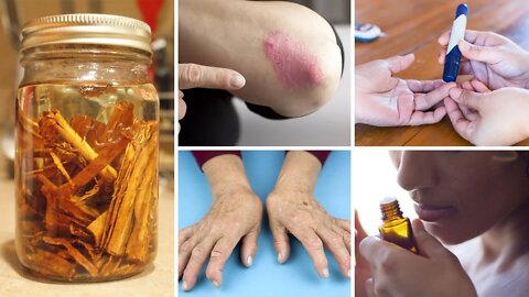 Cinnamon Oil: 5 Surprising Benefits and Uses (DIY recipe)
