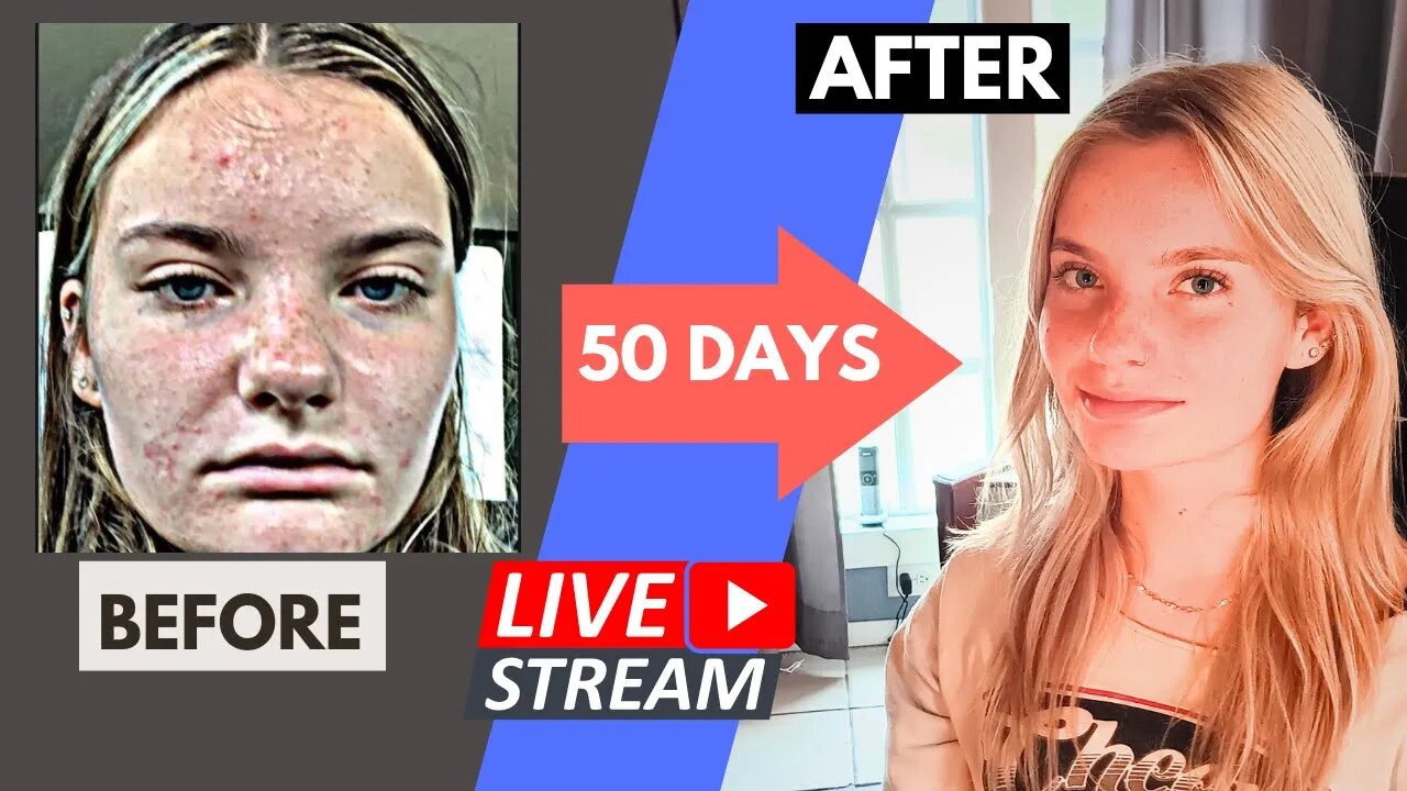 From Vegan to Carnivore: Teen's 50-Day Update Live Stream