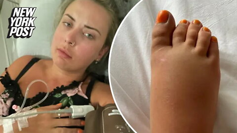 Honeymoon ruined after bride stung by world's most venomous fish