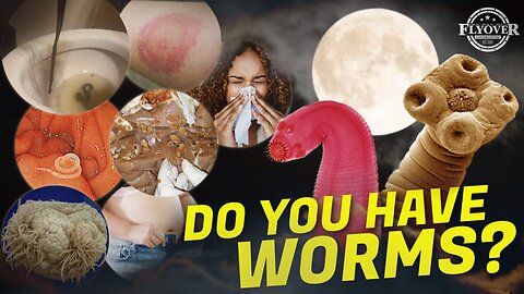 DO YOU HAVE WORMS? Bloating, Lymes, Tired, Hungry, Allergies, Gas, Drowsy after Eating, Struggles Losing Weight - Dr. Jason Dean