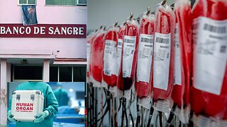 Donaciones de órganos, sangre, rituales y más 2/3 #Cuba