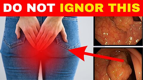 Early Warning Signs Of Colon Cancer You Should Not Ignore