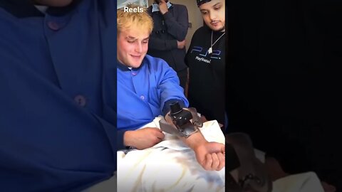 👦 JAKE PAUL CRAZY SURGERY 😱🤯