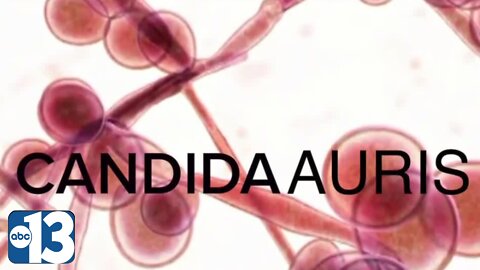 Southern Nevada now has highest number of potentially lethal fungus cases