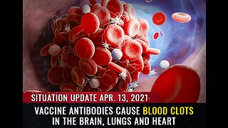 Covid Death Numbers - 43 Million in the First 3 Days