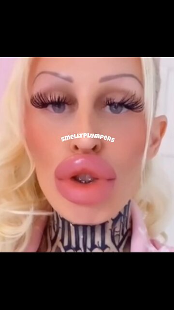 Bolted Botched Lips 😈