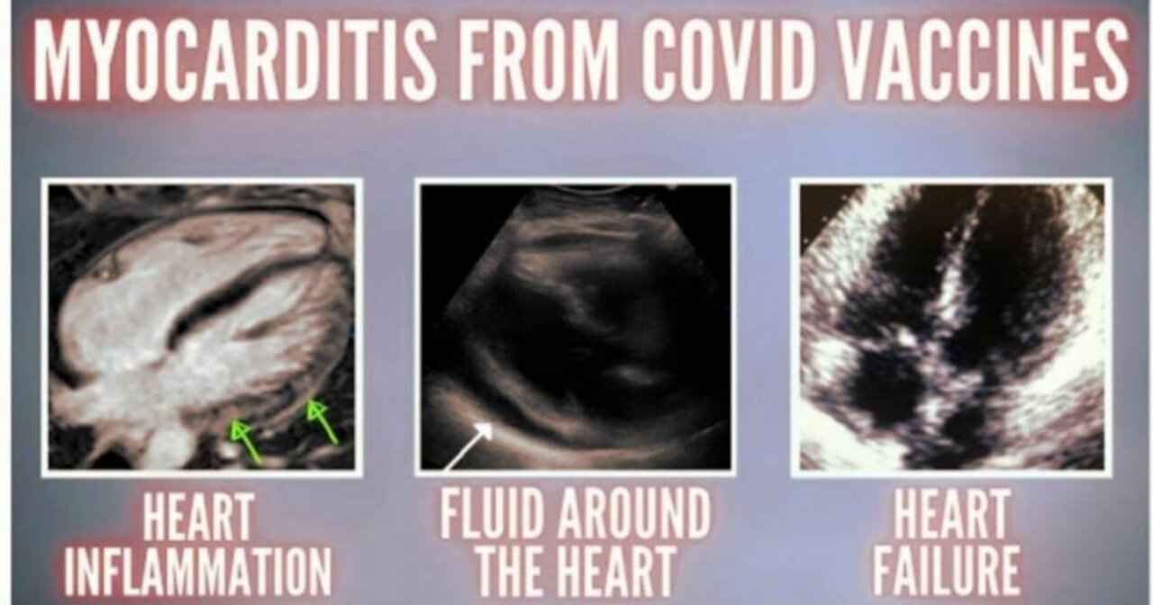 9-22-21 New Study Shows 1 in 1000 Develop Heart Inflammation After Covid Vaccination