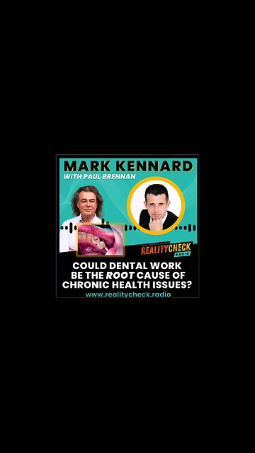 Could Dental Work Be The Root Cause Of Chronic Health Issues
