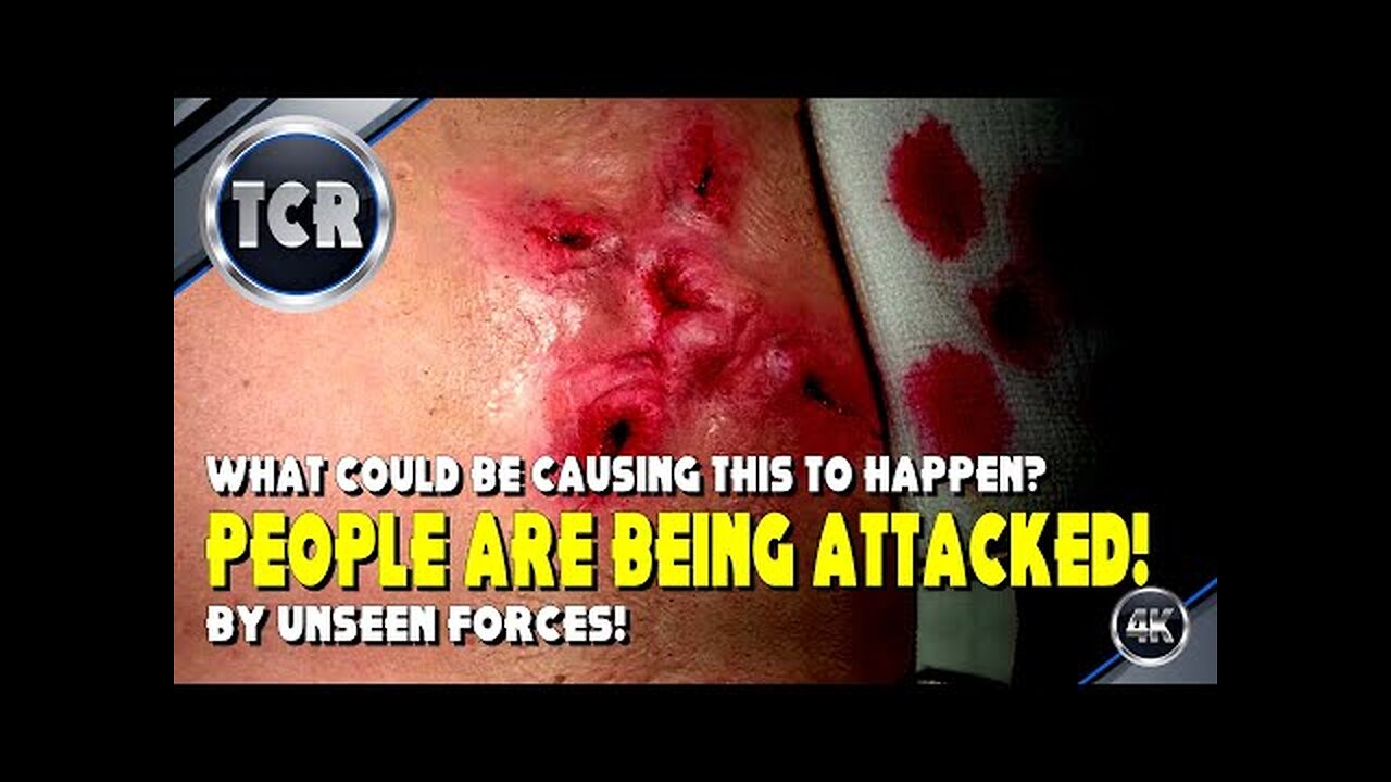 People Are Being Attacked by Unseen Forces. What Could Be Doing This?