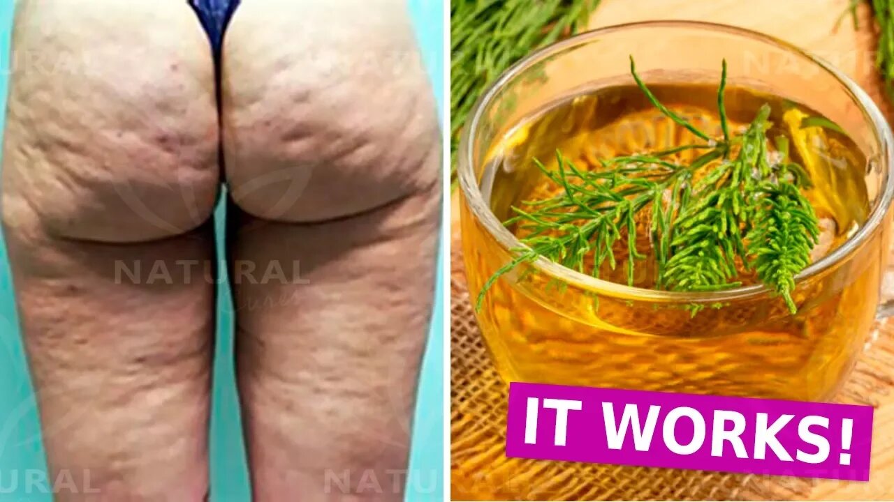 How to Get Rid of Cellulite Naturally