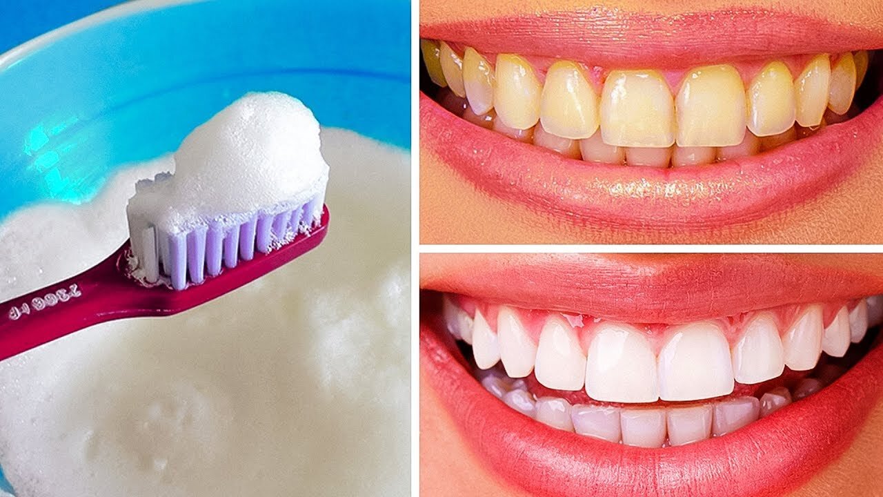 10 Natural Ways to Whiten Teeth at Home