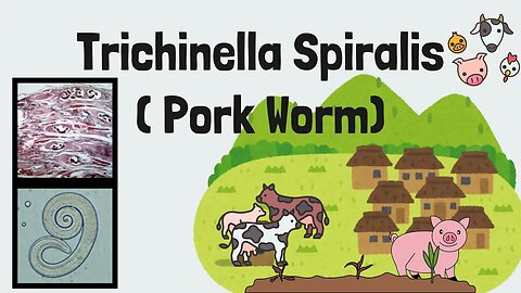 Trichinella spiralis Explained: Guide to the Pork Worm, Trichinosis, and Intestinal Nematodes