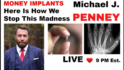 MONEY IMPLANTS