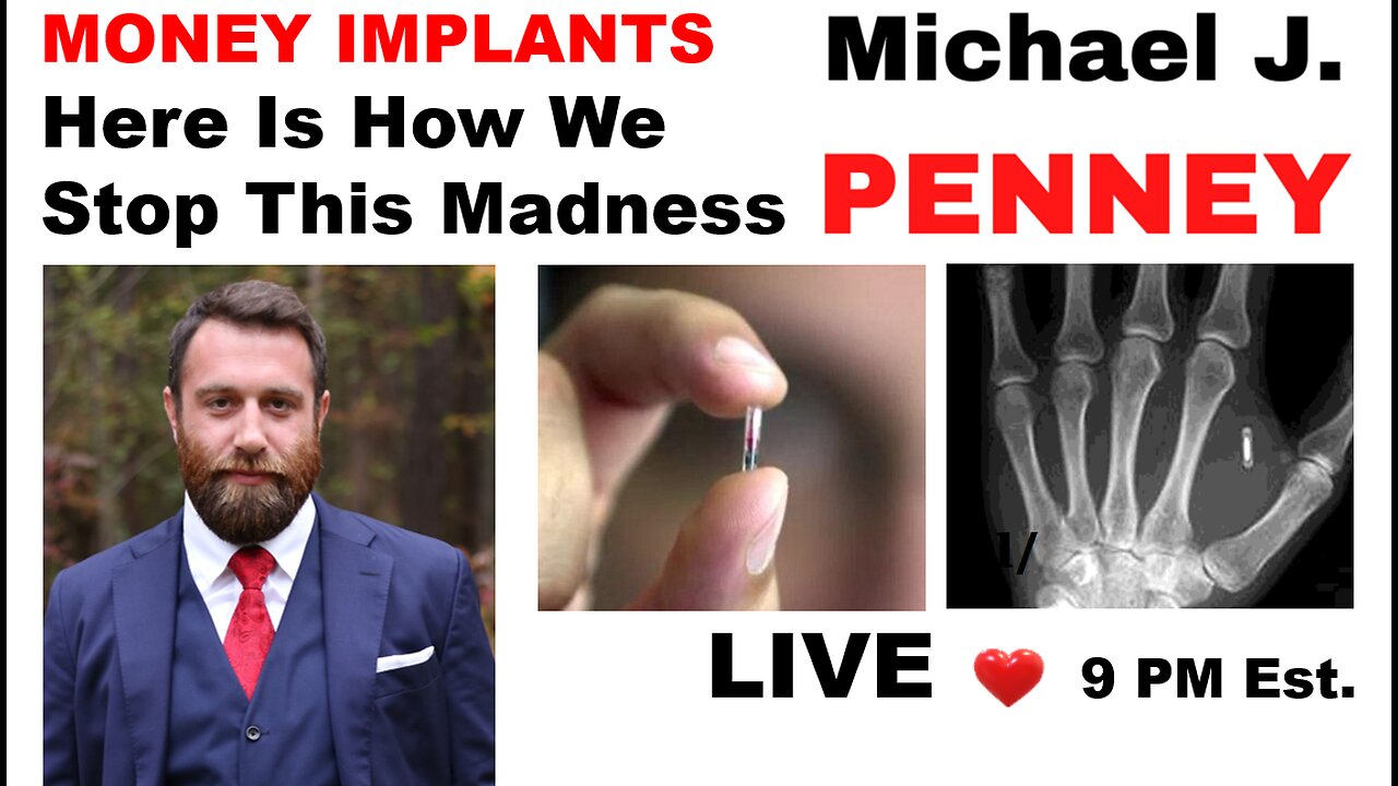 MONEY IMPLANTS