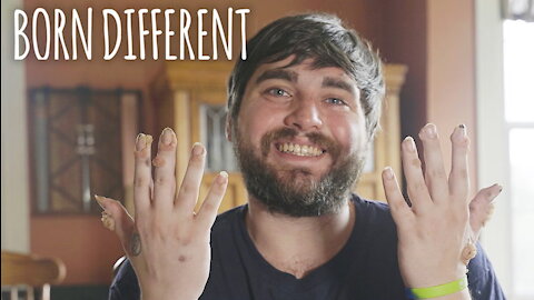 My Hands And Feet Are Covered In Growths | BORN DIFFERENT