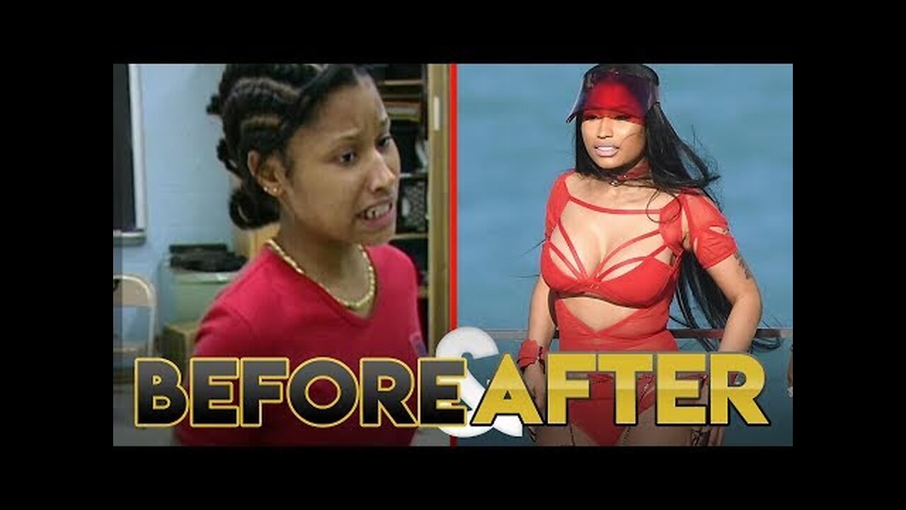 NICKI MINAJ | Before & After Transformation ( Plastic Surgery, Makeup & More )