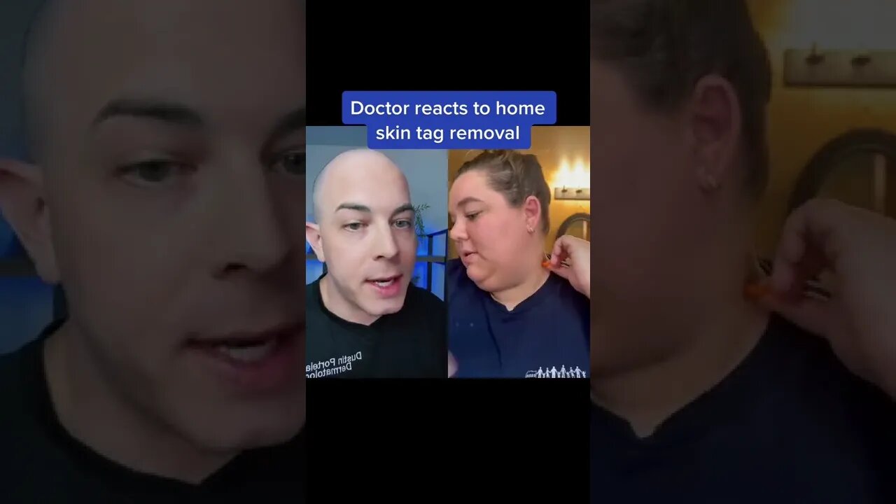 Skin tags removed at home? | 208SkinDoc